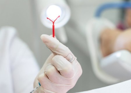 Mulheres de Nova Andradina têm acesso gratuito a DIU e Implanon na rede municipal de saúde